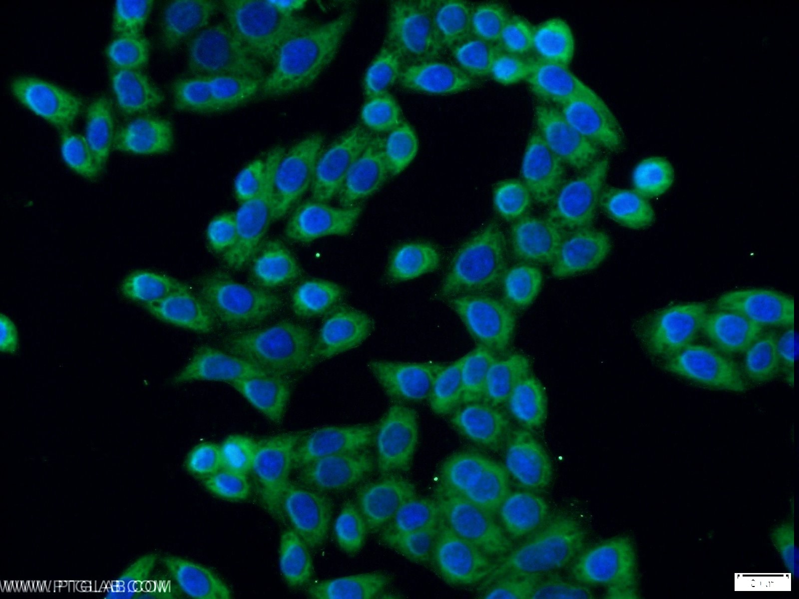 IF Staining of HeLa using 17311-1-AP