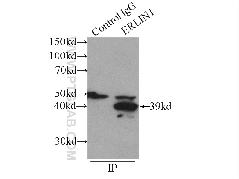 IP experiment of mouse heart using 17311-1-AP