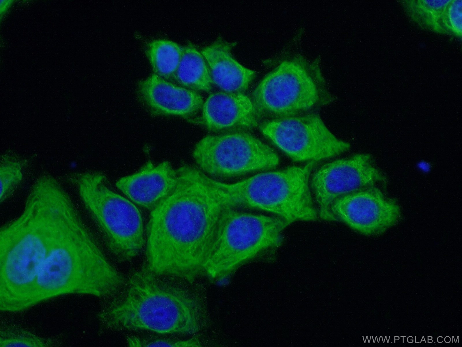 IF Staining of MCF-7 using 21375-1-AP