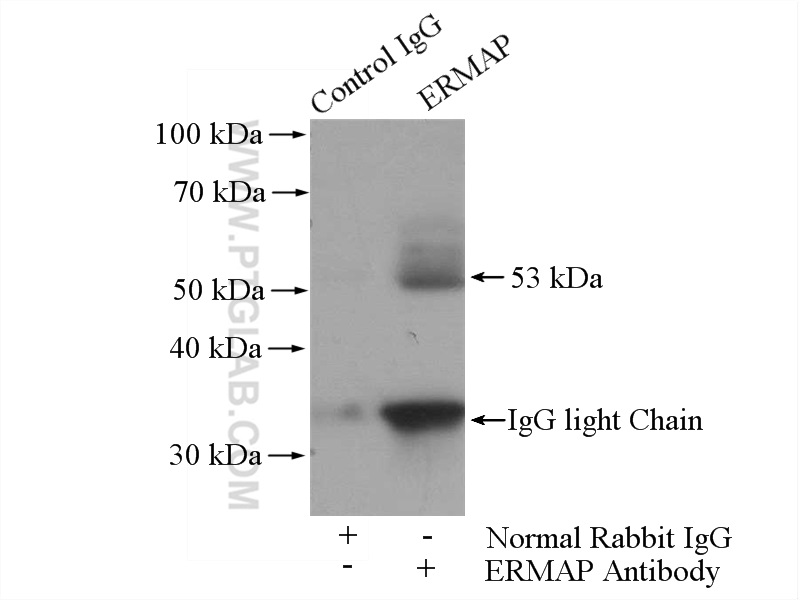 IP experiment of MCF-7 using 21375-1-AP