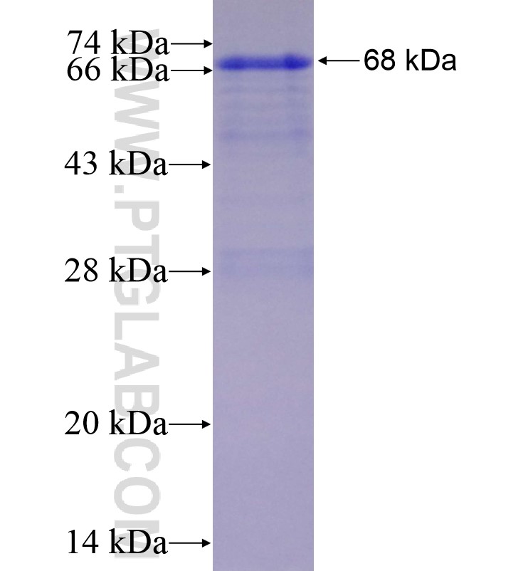 IRE1; ERN1 fusion protein Ag16303 SDS-PAGE IRE1; ERN1 fusion protein Ag16303 SDS-PAGE