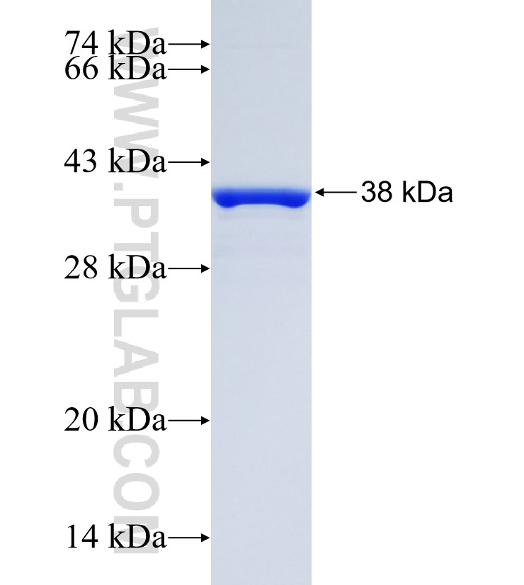 ERN2 fusion protein Ag29456 SDS-PAGE ERN2 fusion protein Ag29456 SDS-PAGE