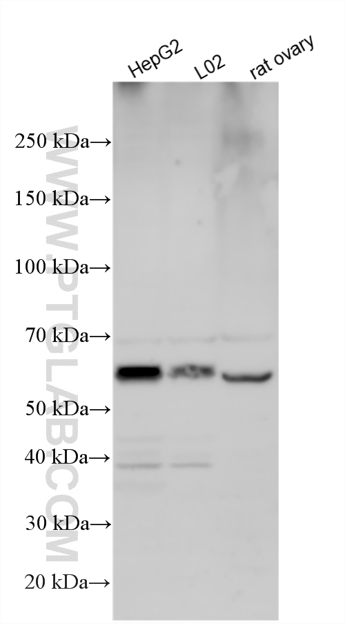 Various lysates were subjected to SDS PAGE followed by western blot with 12007-1-AP (ERO1L antibody) at dilution of 1:1500 incubated at room temperature for 1.5 hours. WB analysis using 12007-1-AP