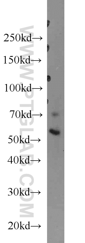 WB analysis of mouse ovary using 12007-1-AP