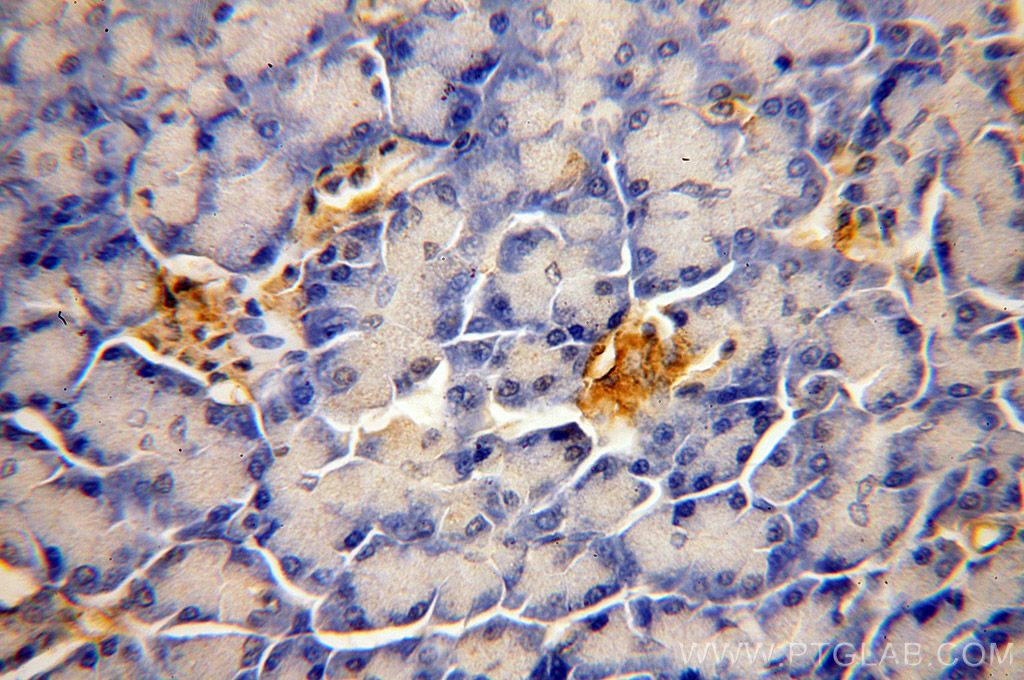 IHC staining of human pancreas using 18313-1-AP