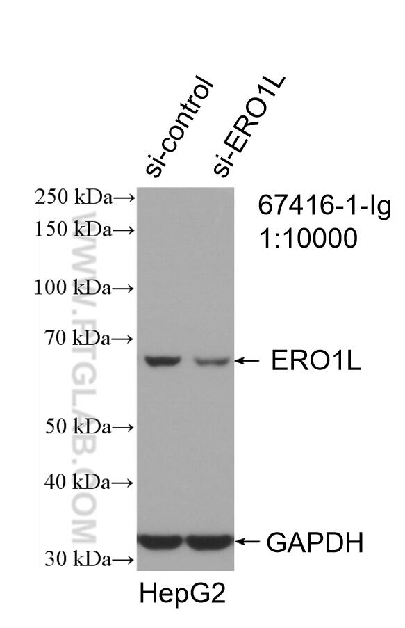 WB analysis of HepG2 using 67416-1-Ig