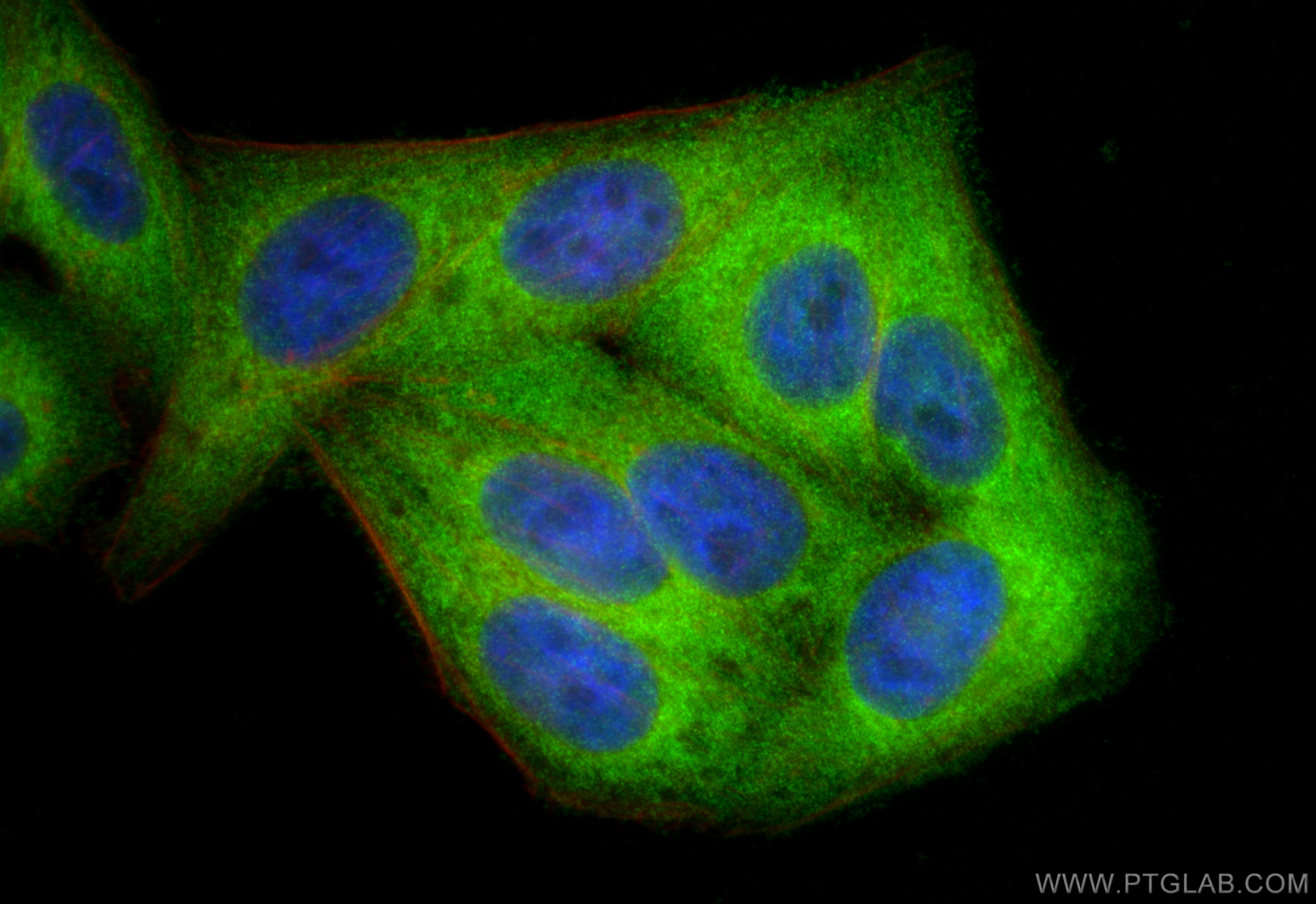IF Staining of HepG2 using 11261-2-AP