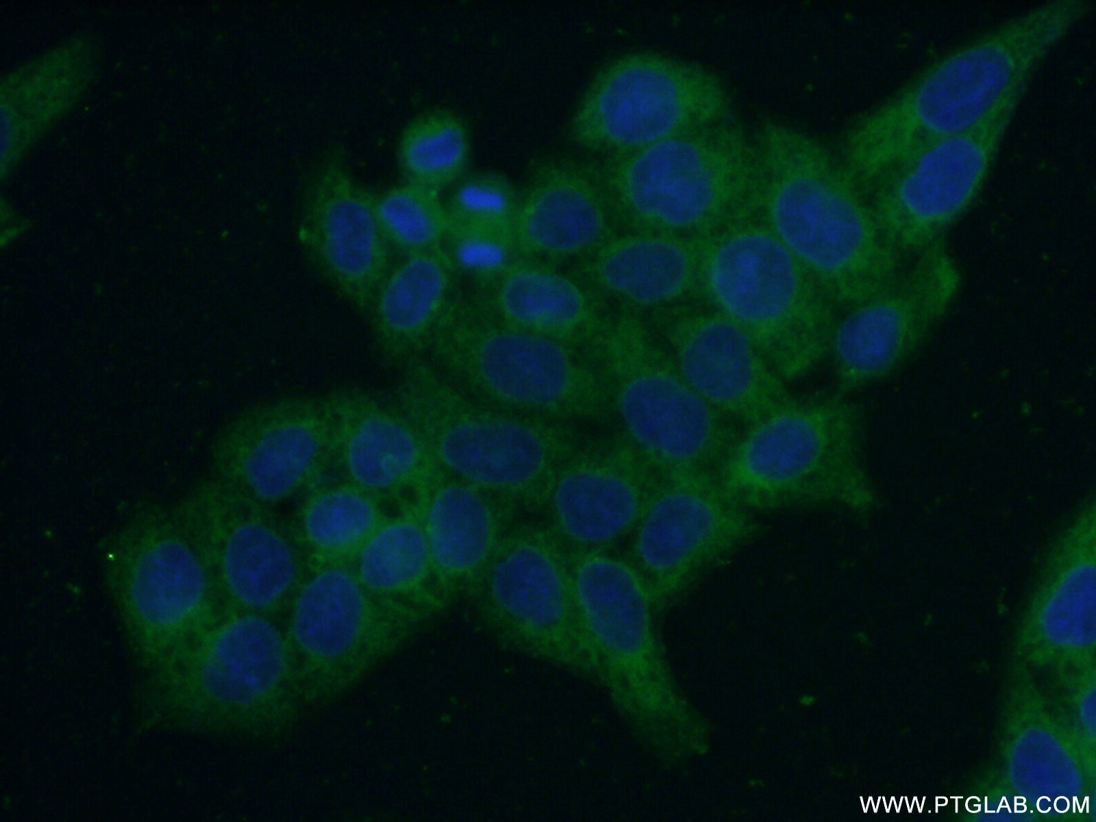 IF Staining of HeLa using 11261-2-AP
