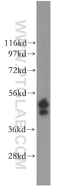 WB analysis of HeLa using 11261-2-AP