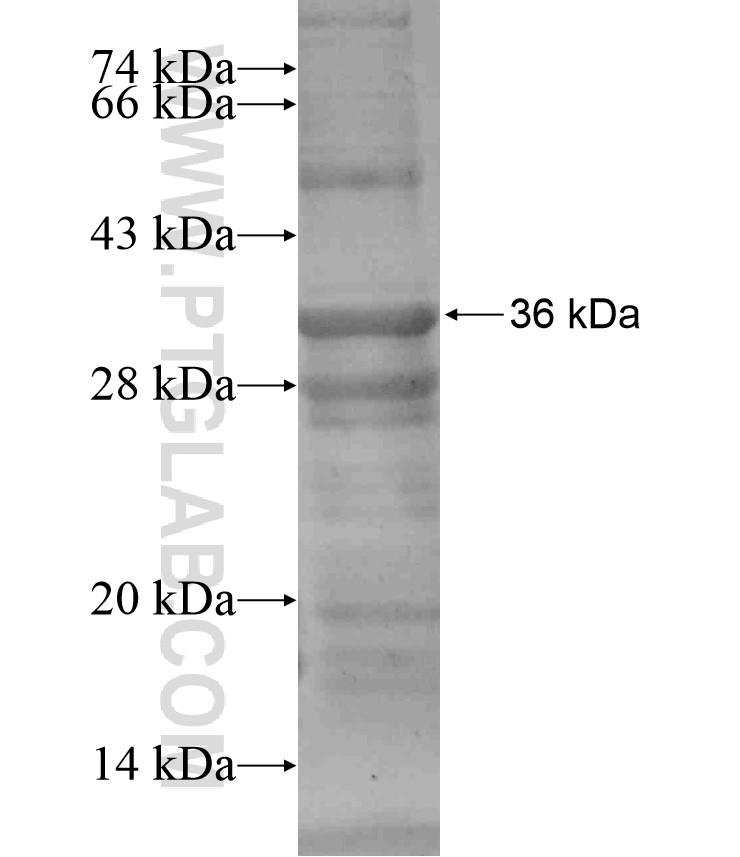ERO1LB fusion protein Ag17920 SDS-PAGE ERO1LB fusion protein Ag17920 SDS-PAGE