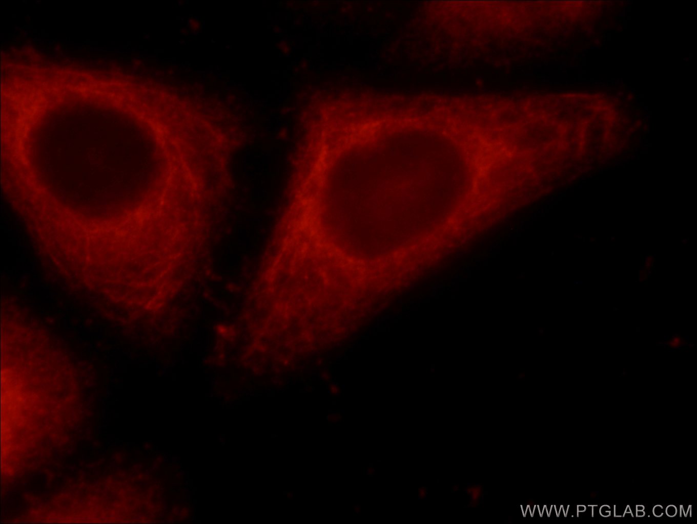 IF Staining of HeLa using 24344-1-AP