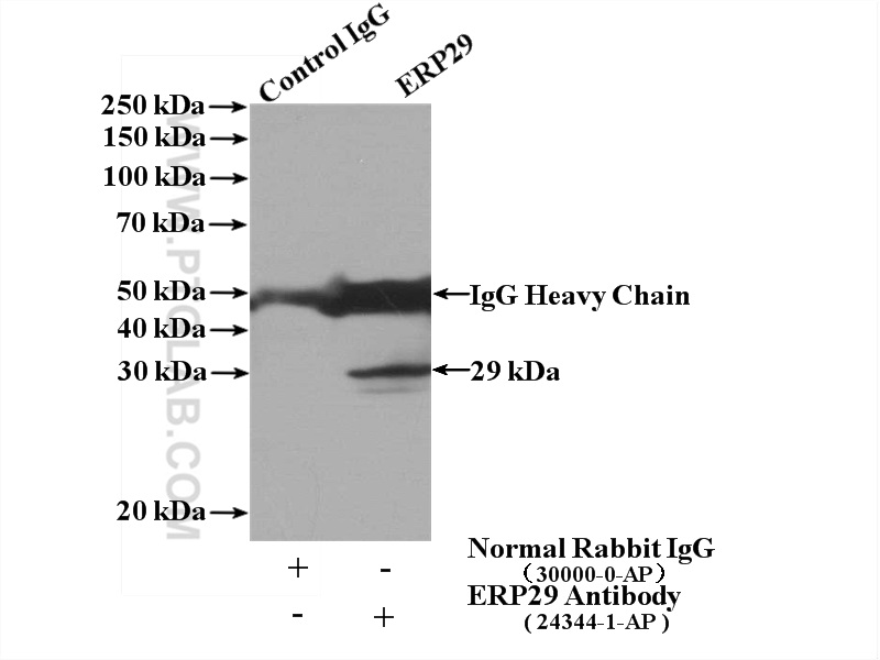 IP experiment of mouse liver using 24344-1-AP