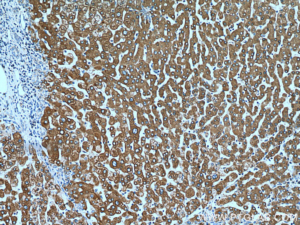 IHC staining of human liver using 67675-1-Ig