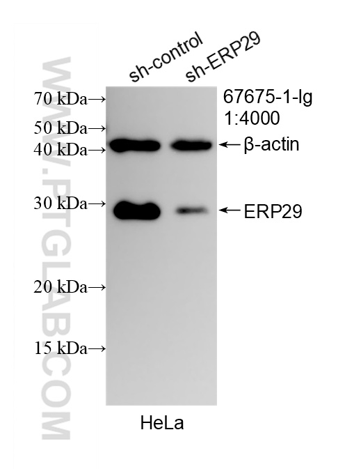 WB analysis of HeLa using 67675-1-Ig WB analysis of HeLa using 67675-1-Ig