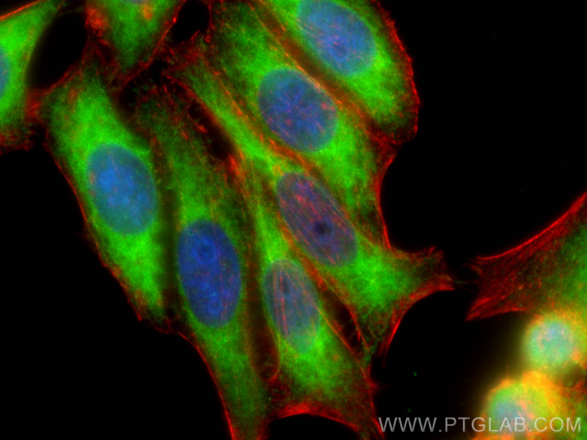 IF Staining of HepG2 using 11630-1-AP