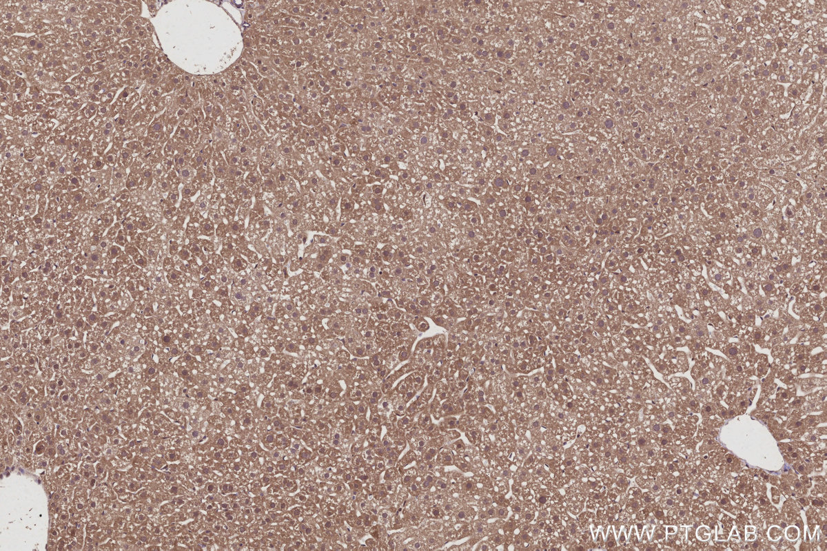 IHC staining of mouse liver using 11630-1-AP IHC staining of mouse liver using 11630-1-AP