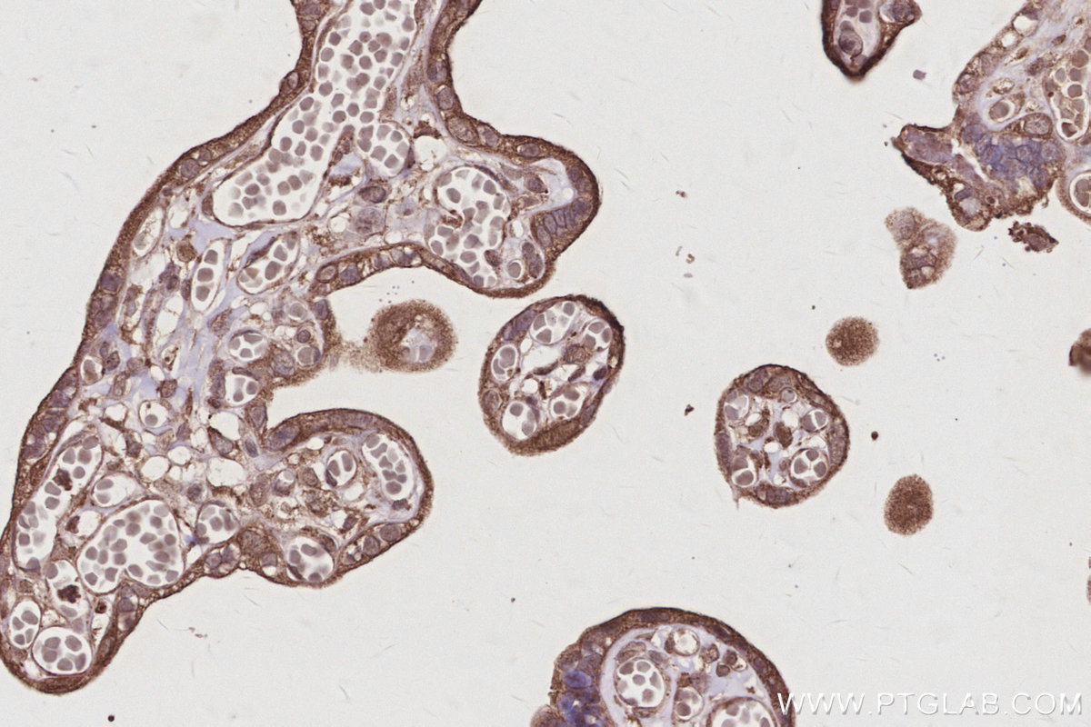 IHC staining of human placenta using 11630-1-AP IHC staining of human placenta using 11630-1-AP