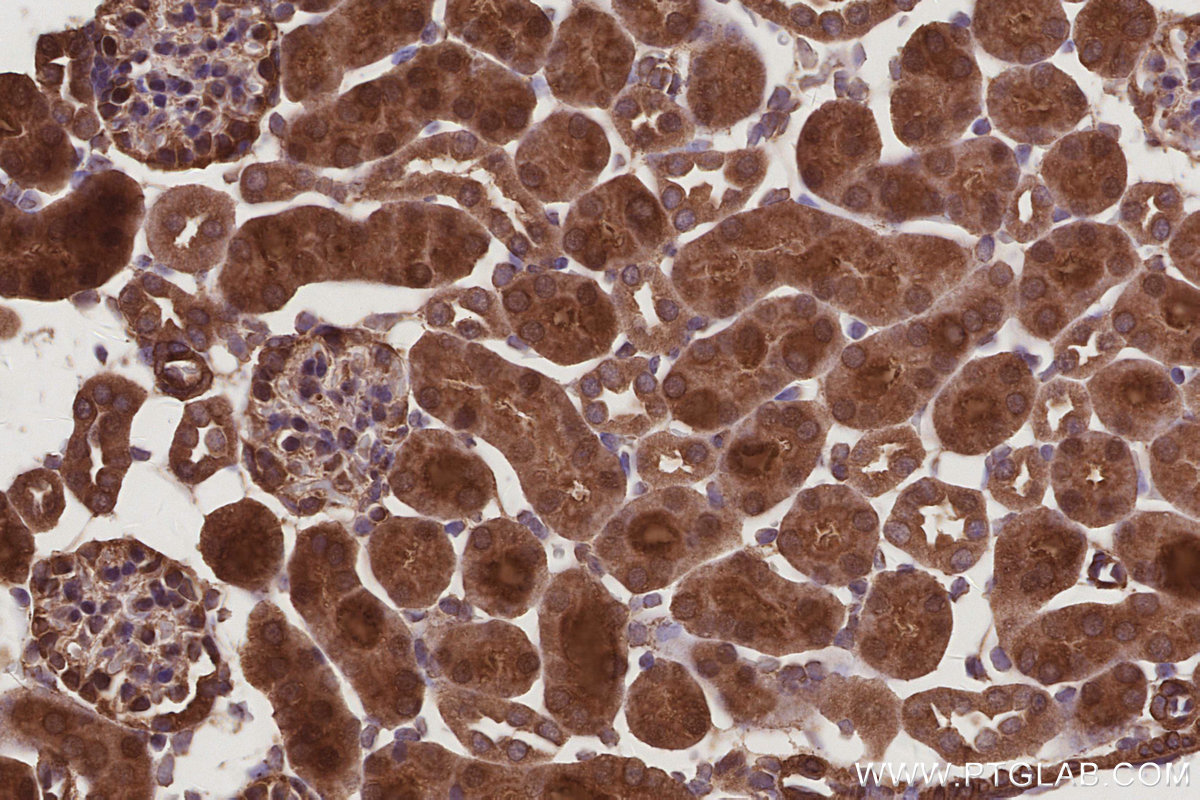 IHC staining of mouse kidney using 11630-1-AP IHC staining of mouse kidney using 11630-1-AP
