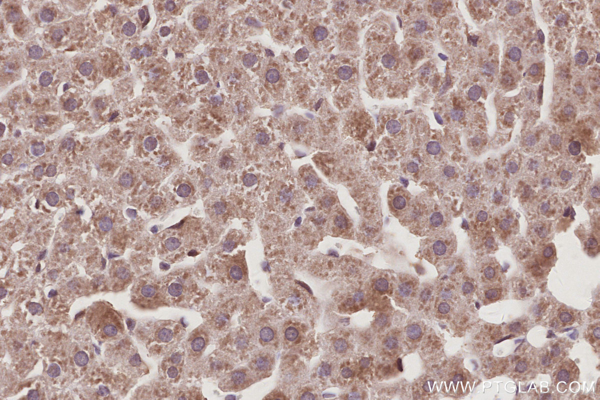 IHC staining of rat liver using 11630-1-AP IHC staining of rat liver using 11630-1-AP