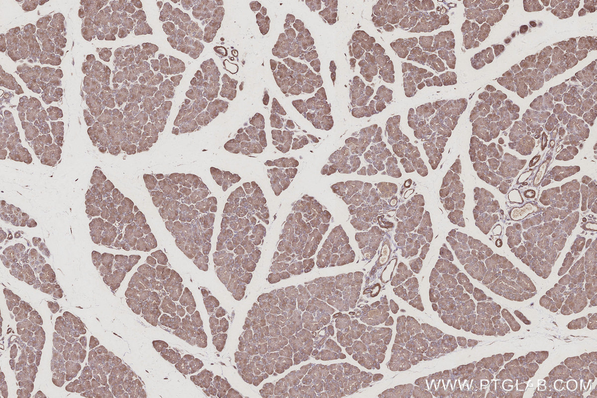 IHC staining of rat pancreas using 11630-1-AP IHC staining of rat pancreas using 11630-1-AP