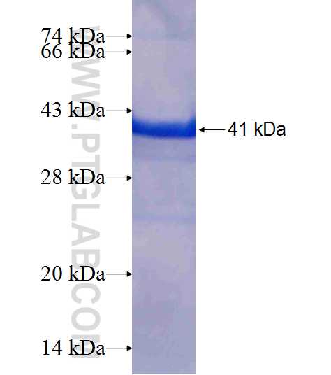 ERp72 fusion protein Ag6873 SDS-PAGE