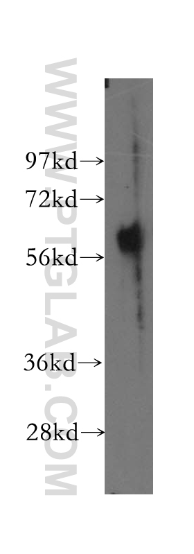 WB analysis of human lung using 12445-1-AP