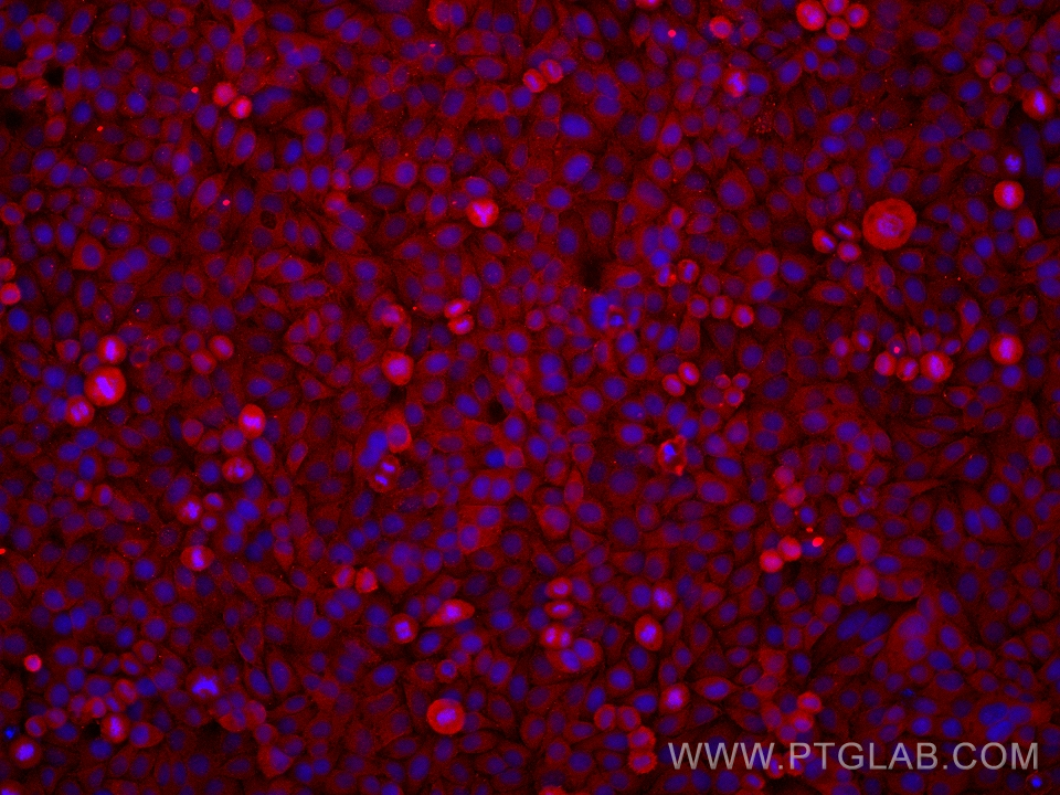 IF Staining of HepG2 using 67069-3-Ig (same clone as 67069-3-PBS)