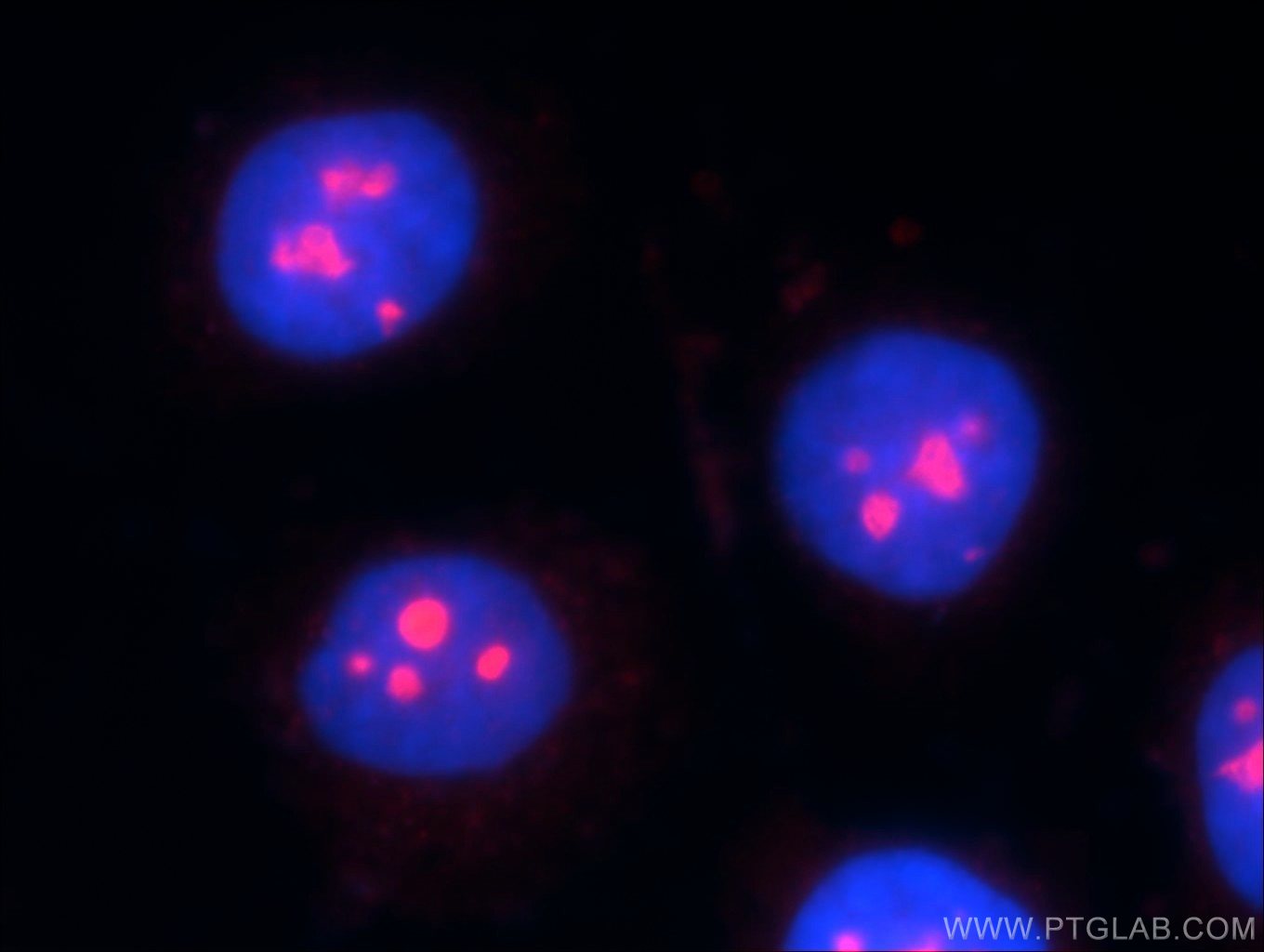 IF Staining of MCF-7 using 23496-1-AP