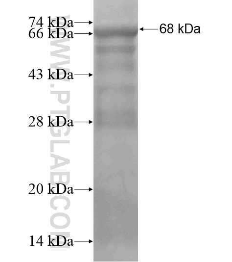 ESF1 fusion protein Ag19041 SDS-PAGE ESF1 fusion protein Ag19041 SDS-PAGE