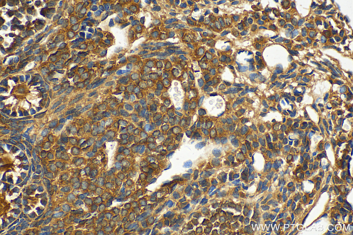 IHC staining of mouse ovary using 14007-1-AP