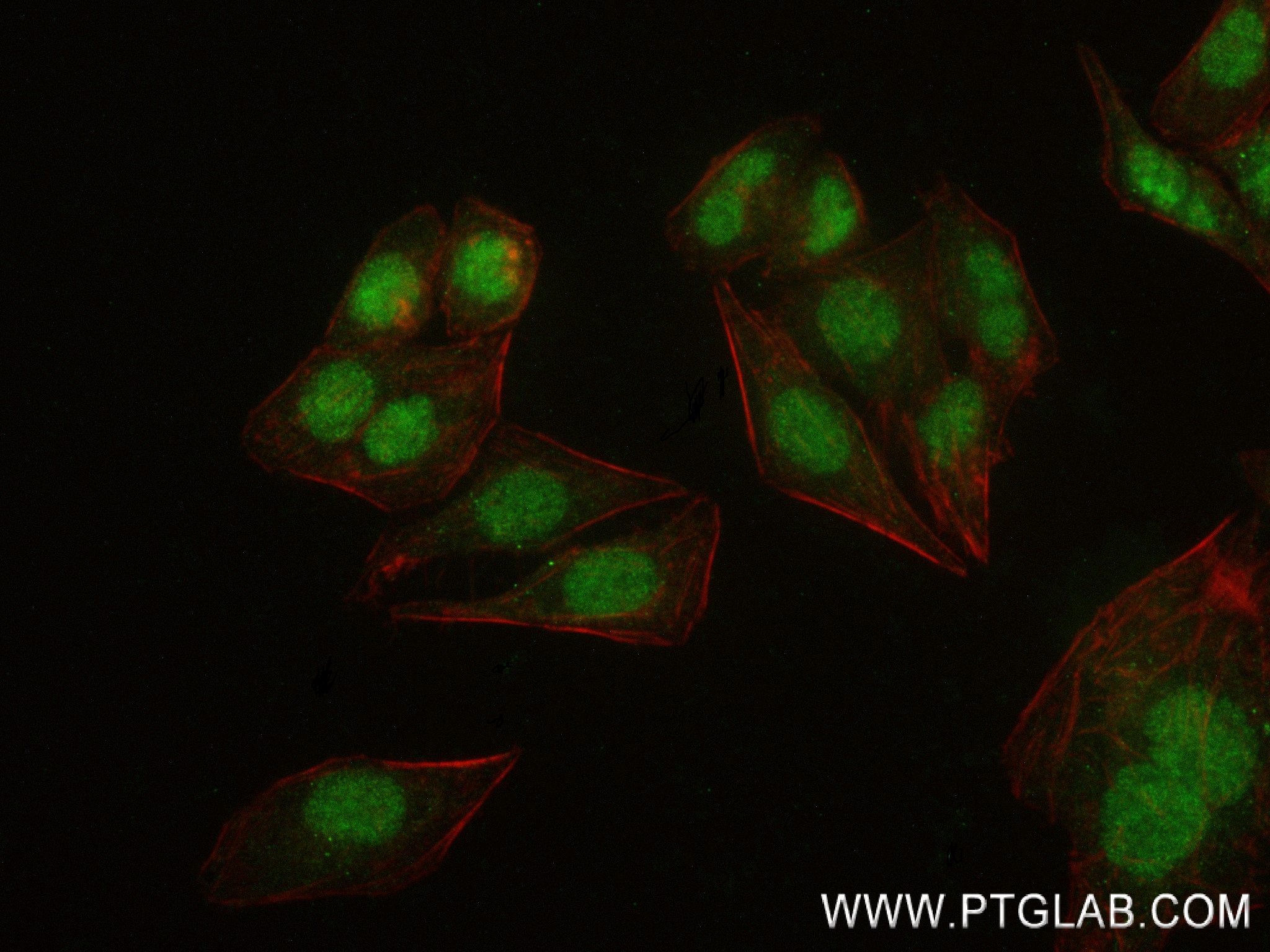 IF Staining of HepG2 using 83447-3-RR
