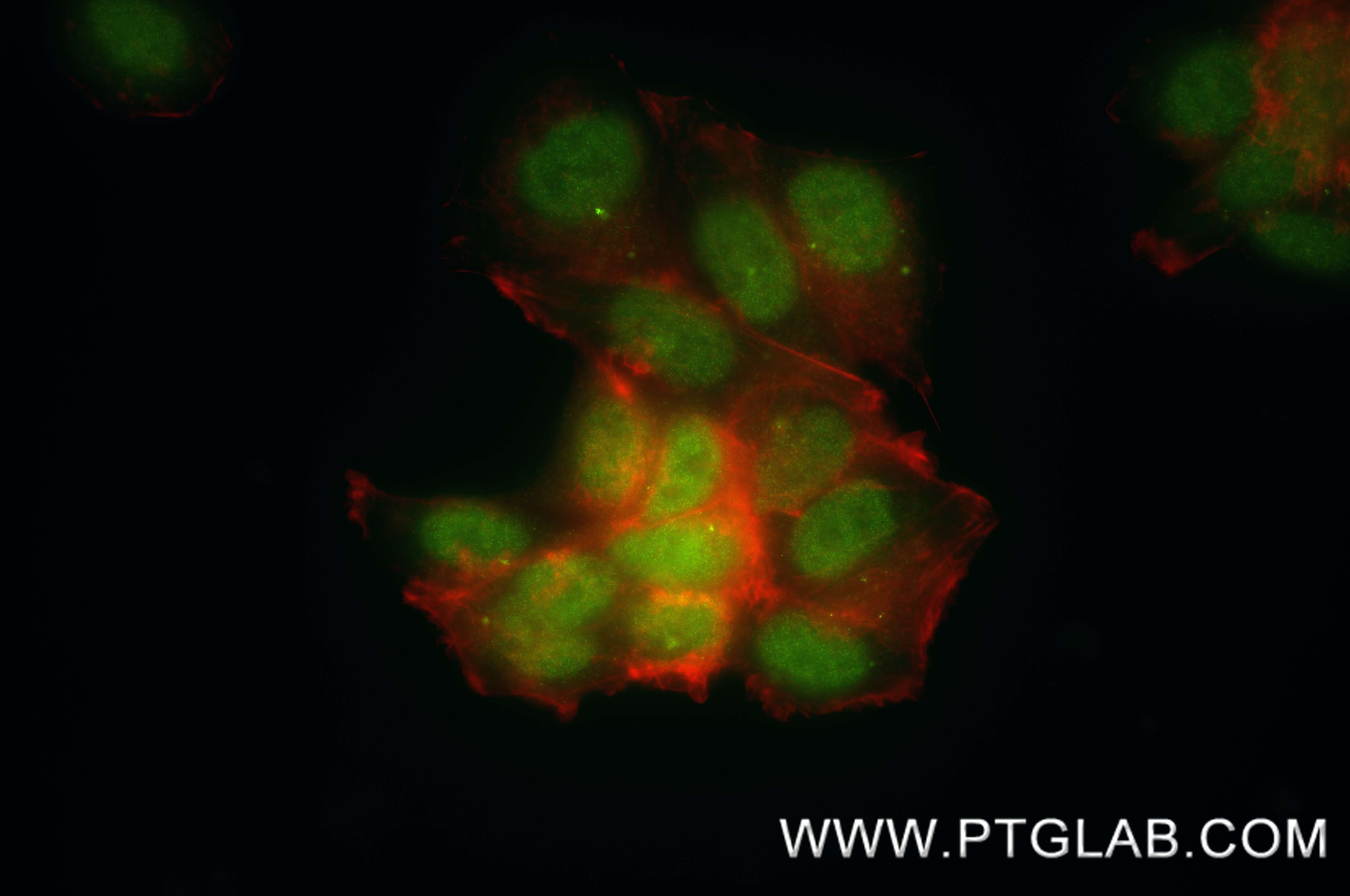 IF Staining of MCF-7 using 83447-3-RR IF Staining of MCF-7 using 83447-3-RR