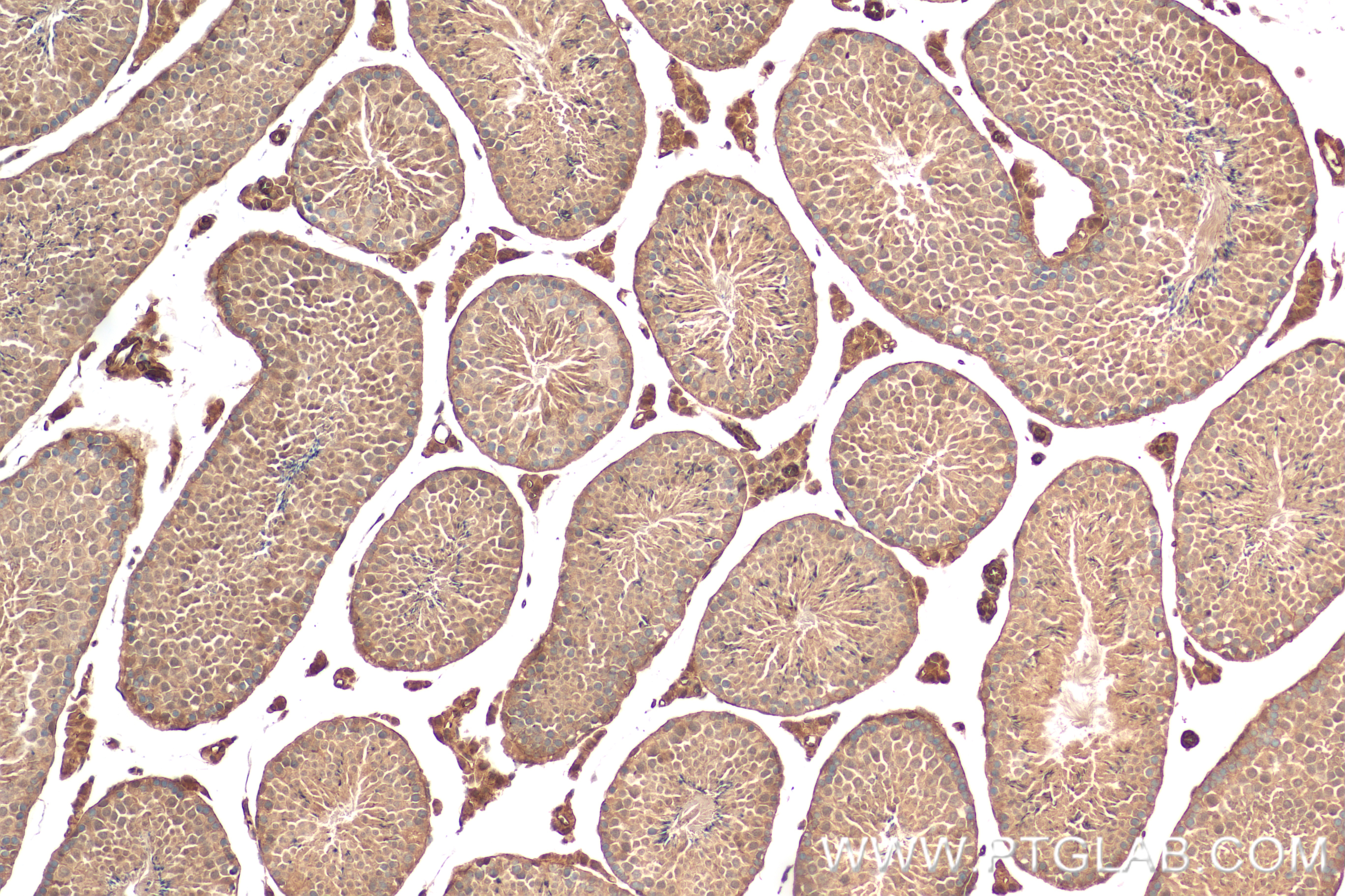 IHC staining of mouse testis using 83447-3-RR