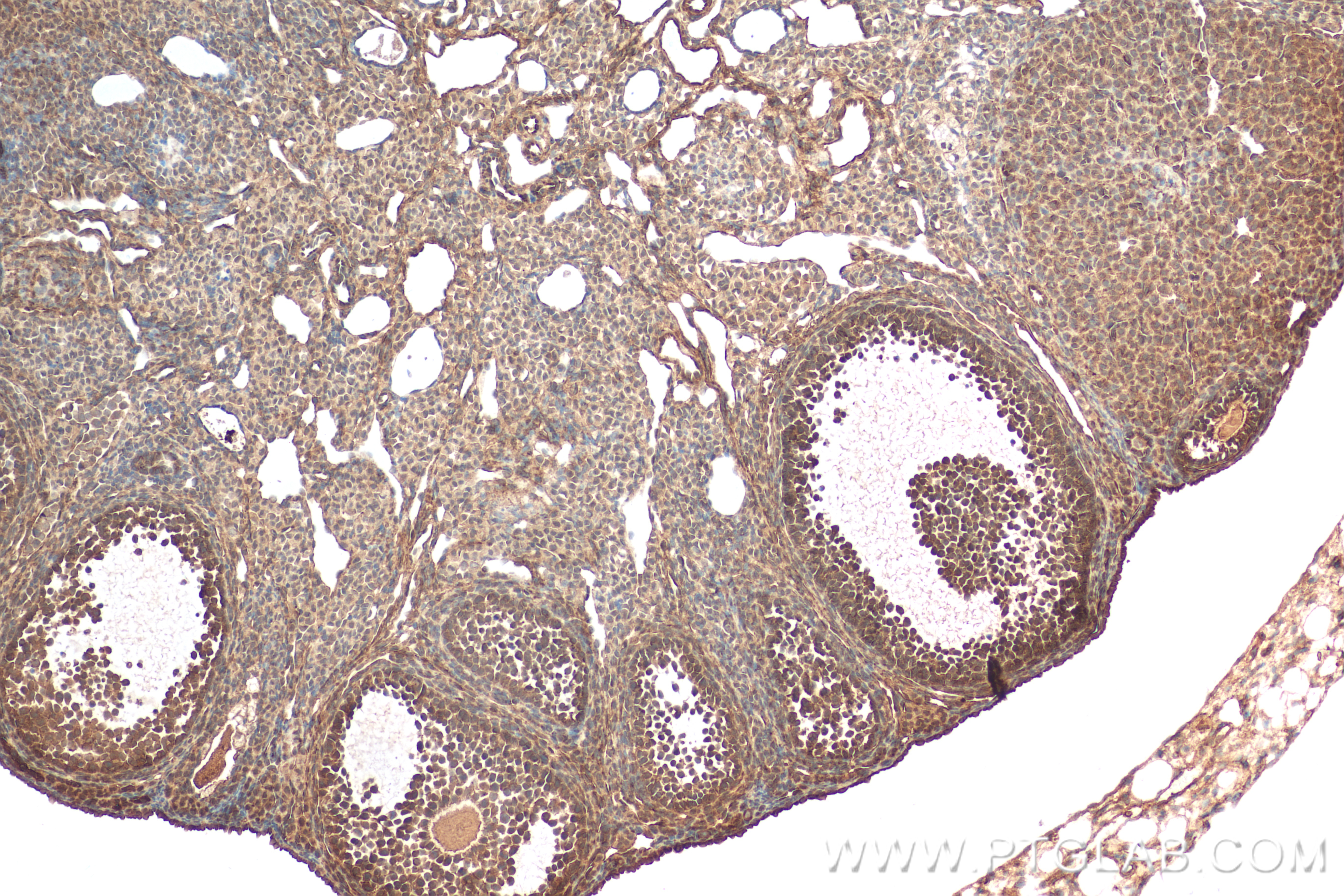 IHC staining of mouse ovary using 83447-3-RR