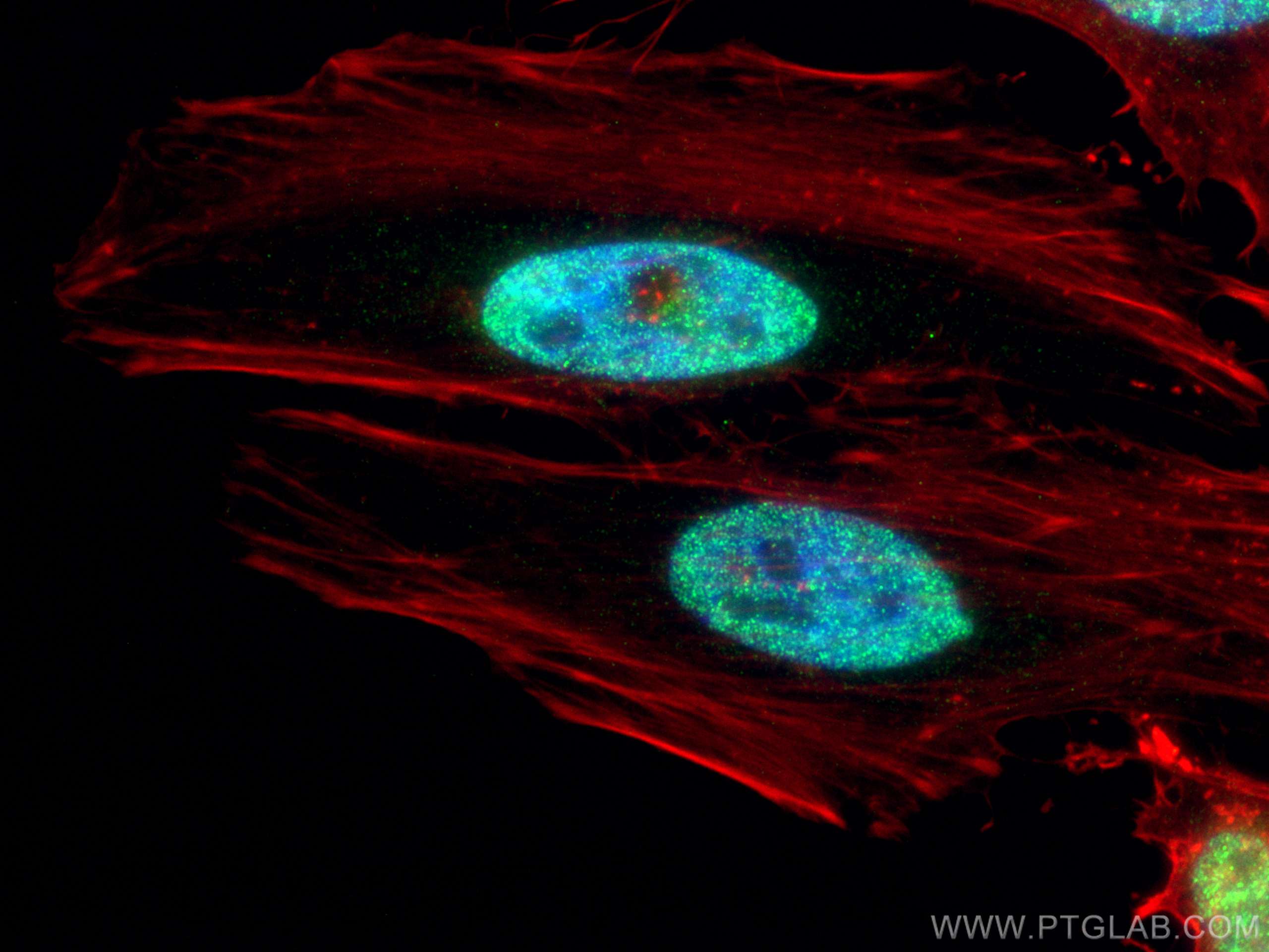 IF Staining of HeLa using 55471-1-AP