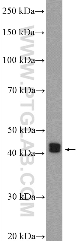 WB analysis of mouse spleen using 55471-1-AP