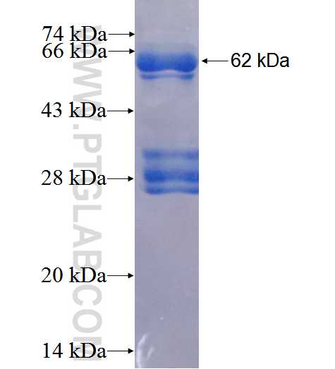 ESR2 fusion protein Ag5103 SDS-PAGE