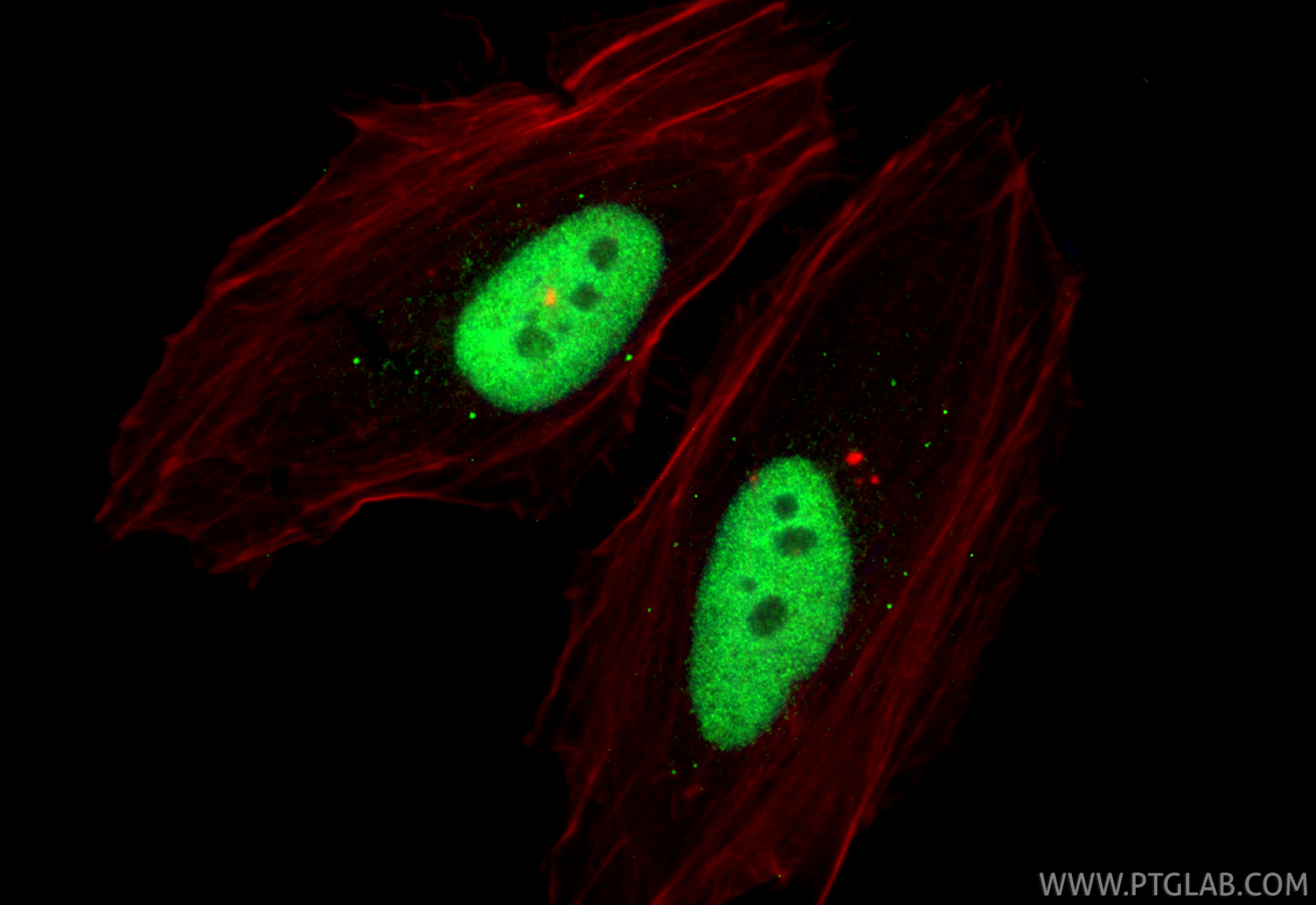 IF Staining of HeLa using 21045-1-AP IF Staining of HeLa using 21045-1-AP