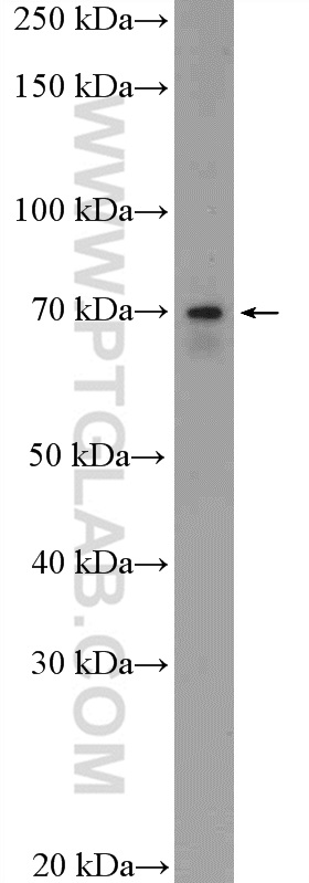 ESRP1