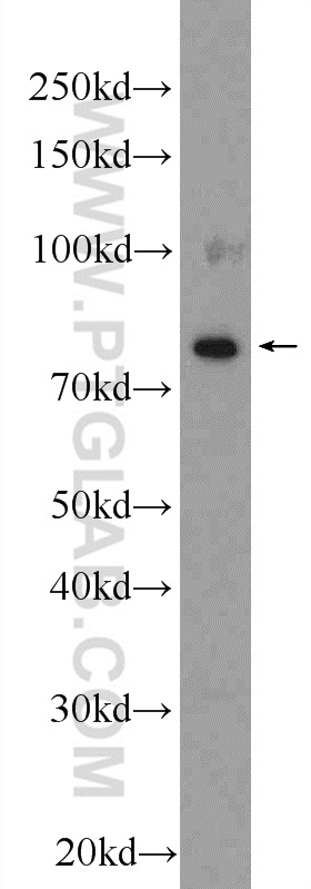 ESRP2