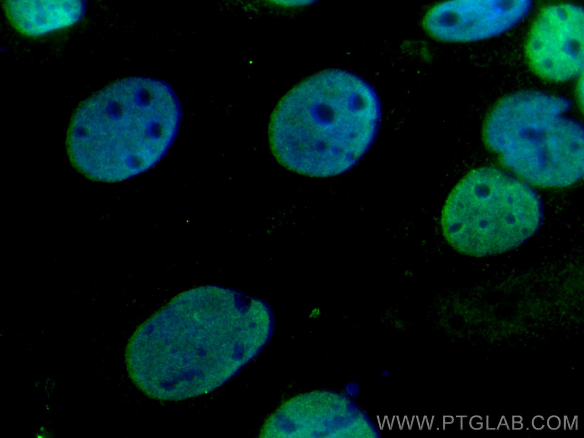 IF Staining of Caco-2 using 66818-1-Ig