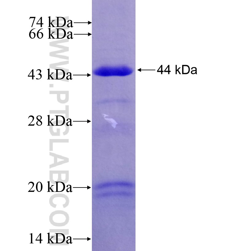 ESRRG fusion protein Ag16660 SDS-PAGE ESRRG fusion protein Ag16660 SDS-PAGE