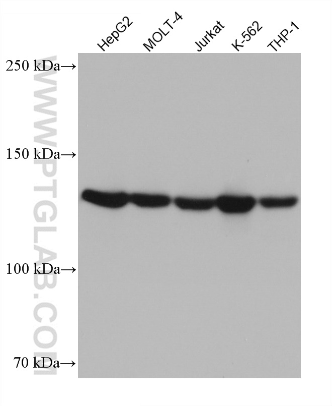 WB analysis using 67688-1-Ig