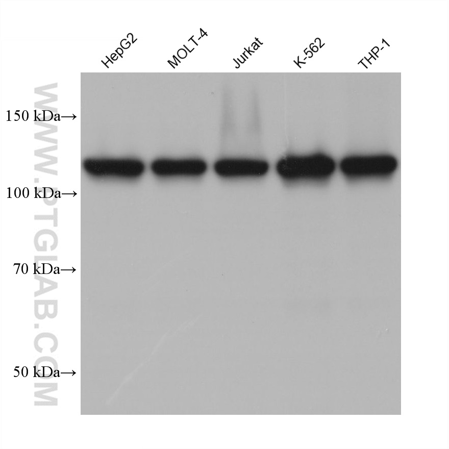 WB analysis using 67688-1-Ig