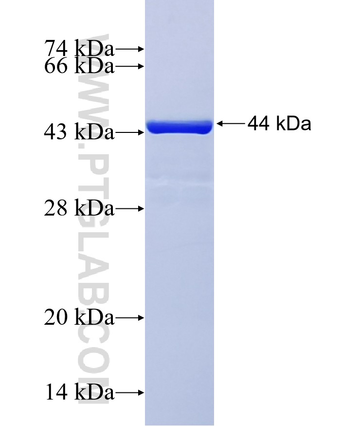ETAA1 fusion protein Ag36606 SDS-PAGE ETAA1 fusion protein Ag36606 SDS-PAGE