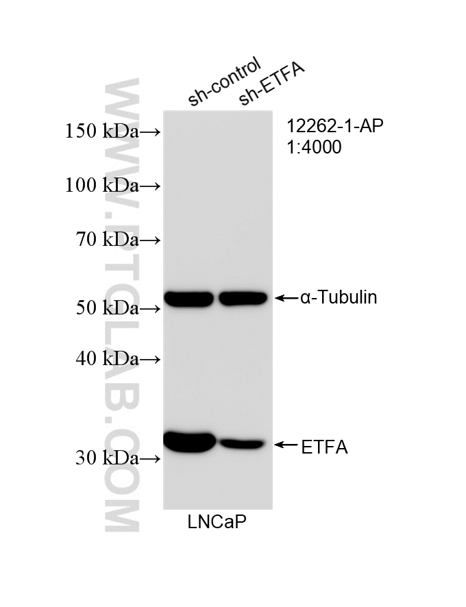 WB analysis of LNCaP using 12262-1-AP WB analysis of LNCaP using 12262-1-AP
