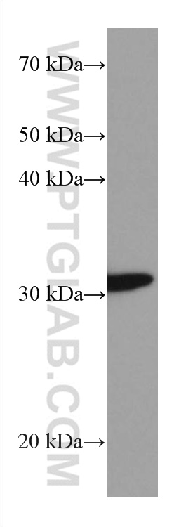 WB analysis of mouse brain using 67661-1-Ig