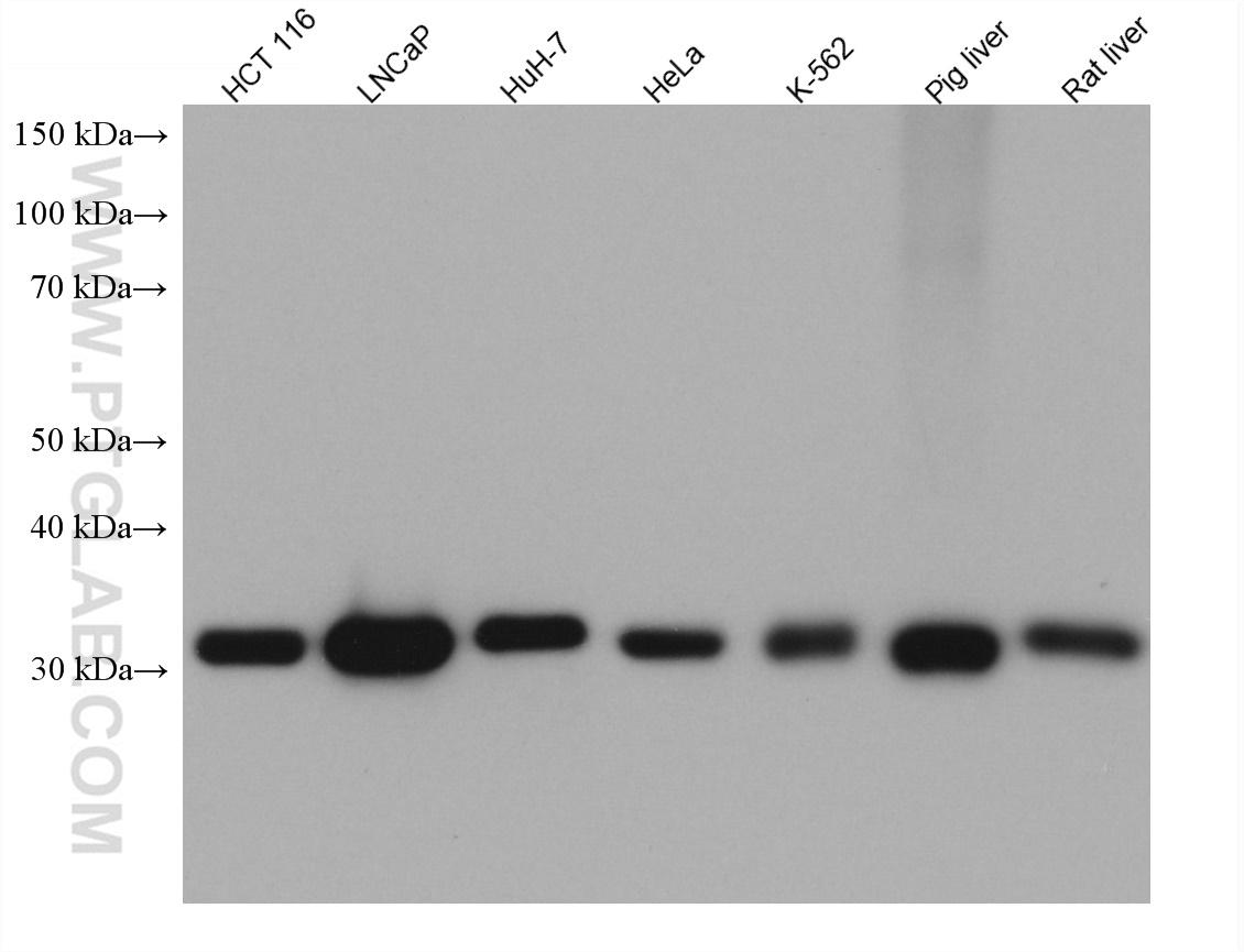 WB analysis using 67661-1-Ig