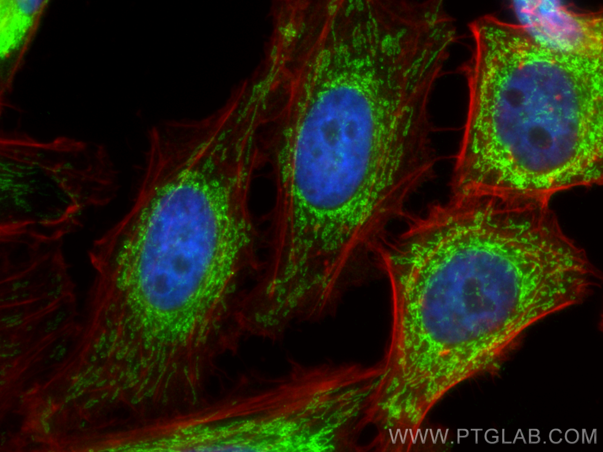IF Staining of HeLa using 17925-1-AP