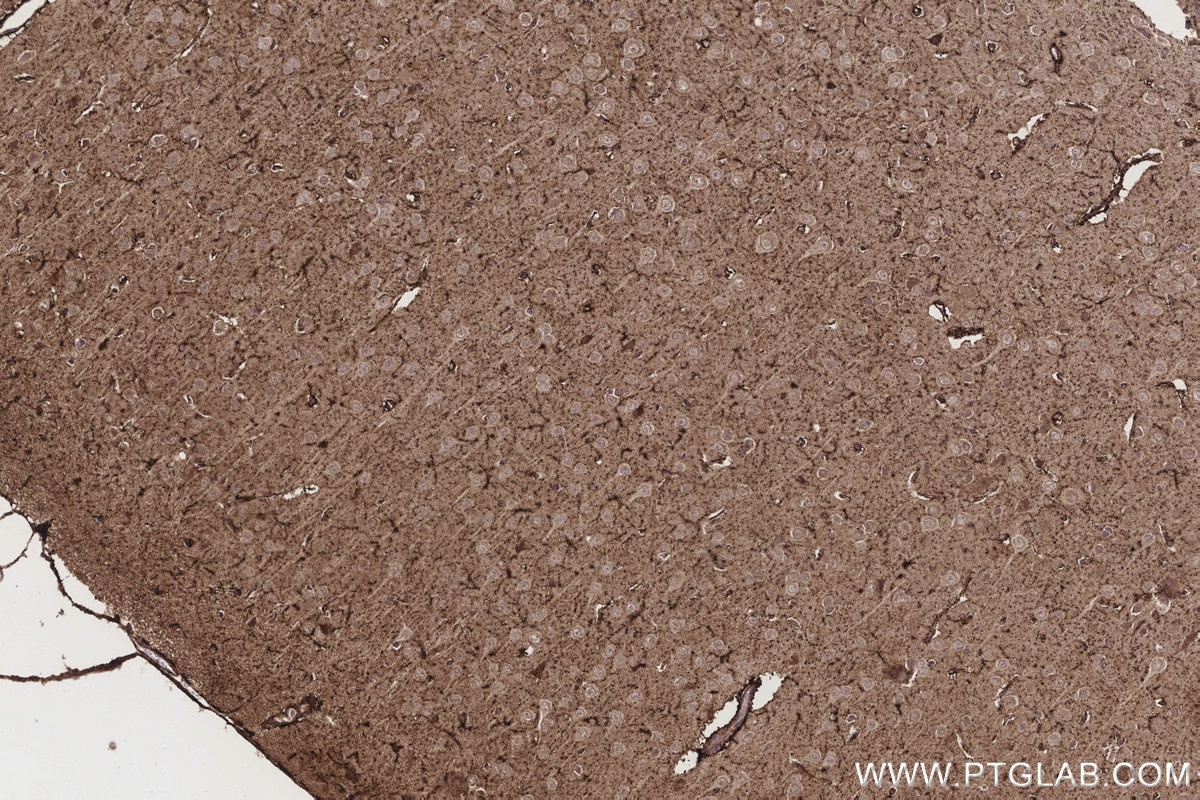 IHC staining of rat brain using 17925-1-AP IHC staining of rat brain using 17925-1-AP